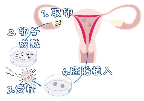 关于包生男孩公司